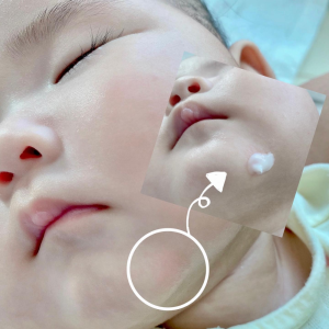 Kem Phục Hồi Chuyên Biệt Atono2 SOS Cream cho bé 20ml (0+) 7 Kem Phuc Hoi Chuyen Biet Sos Cream Atono2 Cho Be Tu 0m 20ml 3