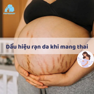 Dau Hieu Ran Da Khi Mang Thai Thumb
