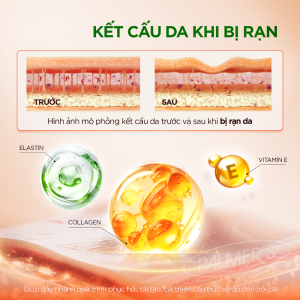 Kem Bo Dam Dac Ngan Ngua Ran Da Vung Bung Palmer 125g 4